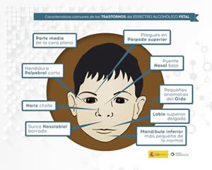 Infografía que muestra las características comunes de los trastornos del Espectro Alcohólico fetal.